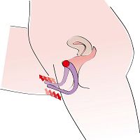 PUNCI SZÉTFESZÍTŐ CSIKLÓ ÉS G-PONT IZGATÓ - DSR 0503517 - 6