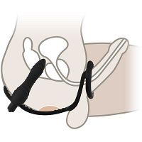 EREKCIÓS GYŰRÜ A HÍMVESSZŐRE ÉS HERÉKRE + ANÁLIS DÚGÓ, VIBRÁLÓ PLUG - 74829497 - 2