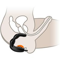 NAGY, FEKETE, SZILIKONOS PROSZTATA MASSZÍROZÓ TÜSKÉKKEL - LBB 040019 - 2