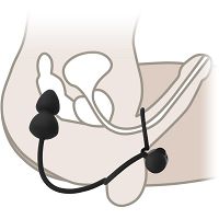 ANÁLIS DÚGÓ DUPLA GYŰRÜVEL A HÍMVESSZŐRE ÉS HERÉKRE + ANUSZ ÉS HASALJ MASSZIROZÓ – 10 FUNKCIÓ - 75837260 - 2